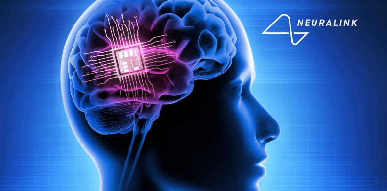 The Future of Brain Implants – Mind-Reading&nbsp;Tech